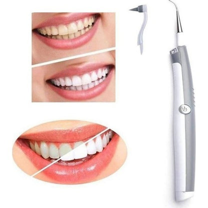 Sonic Electronic Tooth Cleaning System